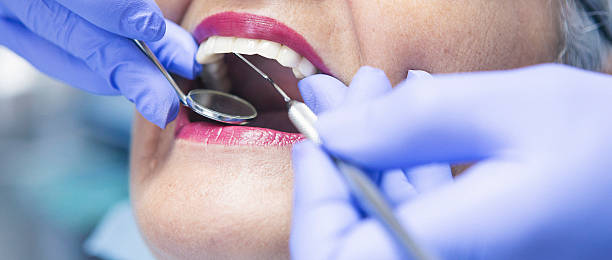 Best Emergency Dentist for Knocked-Out Tooth in Mount Vernon, AL